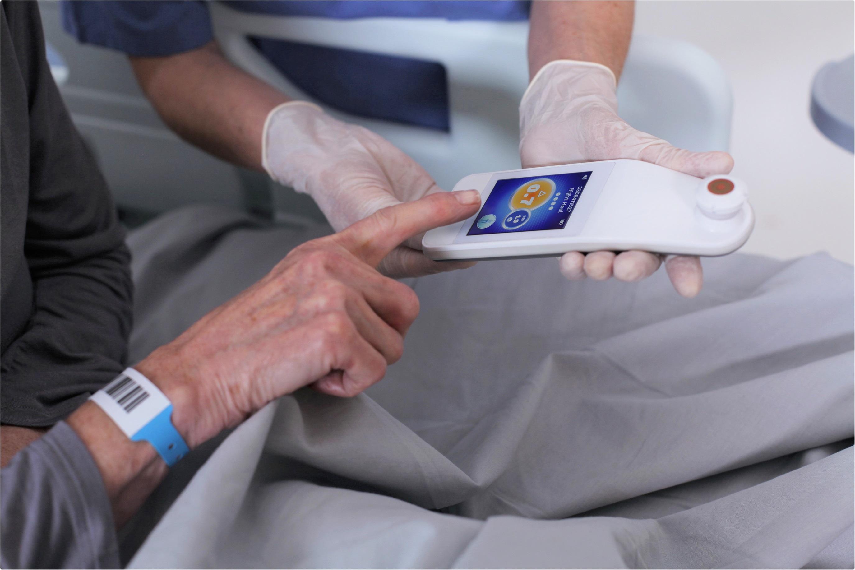 New Pressure Injury Prevention Scanner from BBI